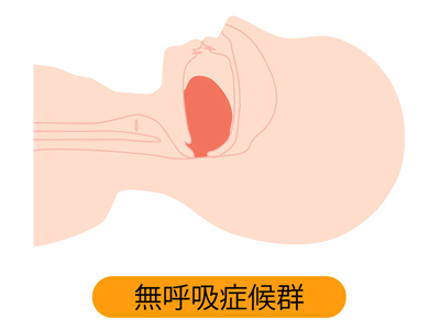 いびき